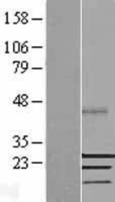 Western Blot SSX2 Overexpression Lysate