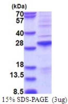 SDS-PAGE Recombinant Human SSX2 His Protein