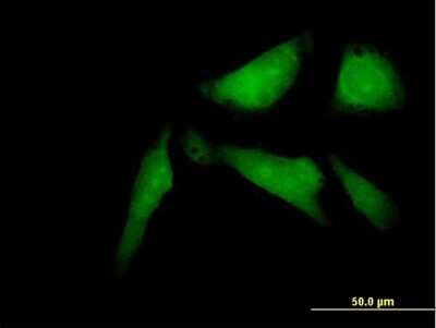 Immunocytochemistry/Immunofluorescence: SSX2IP Antibody [H00117178-B01P] - Analysis of purified antibody to SSX2IP on HeLa cell. (antibody concentration 10 ug/ml)