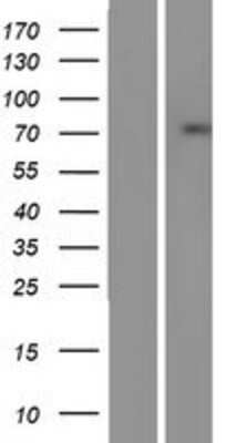 Western Blot: SSX2IP Overexpression Lysate (Adult Normal) [NBP2-07390] Left-Empty vector transfected control cell lysate (HEK293 cell lysate); Right -Over-expression Lysate for SSX2IP.