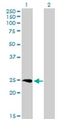 Western Blot: SSX3 Antibody [H00010214-B01P] - Analysis of SSX3 expression in transfected 293T cell line by SSX3 polyclonal antibody.  Lane 1: SSX3 transfected lysate(20.68 KDa). Lane 2: Non-transfected lysate.