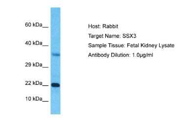 Western Blot: SSX3 Antibody [NBP2-86831] - Host: Rabbit. Target Name: SSX3. Sample Type: Fetal Kidney lysates. Antibody Dilution: 1.0ug/ml