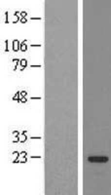 Western Blot: SSX3 Overexpression Lysate (Adult Normal) [NBL1-16486] Left-Empty vector transfected control cell lysate (HEK293 cell lysate); Right -Over-expression Lysate for SSX3.