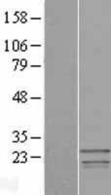 Western Blot: SSX3 Overexpression Lysate (Adult Normal) [NBP2-06576] Left-Empty vector transfected control cell lysate (HEK293 cell lysate); Right -Over-expression Lysate for SSX3.