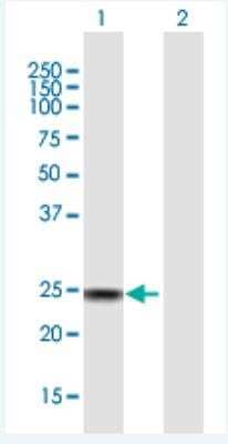 Western Blot: SSX4 Antibody [H00006759-B01P-50ug] - Analysis of SSX4 expression in transfected 293T cell line (H00006759-T01) by SSX4 MaxPab polyclonal antibody.  Lane 1: SSX4 transfected lysate(20.68 KDa). Lane 2: Non-transfected lysate.