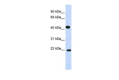 Western Blot: SSX4 Antibody [NBP2-86832] - WB Suggested Anti-SSX4 Antibody Titration: 0.2-1 ug/ml. ELISA Titer: 1:312500. Positive Control: Human Placenta