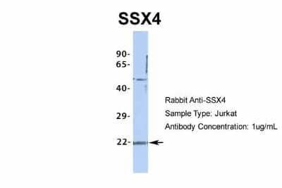 Western Blot: SSX4 Antibody [NBP2-86833] - Host: Rabbit. Target Name: SSX4. Sample Type: Jurkat. Antibody Dilution: 1.0ug/ml