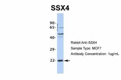 Western Blot: SSX4 Antibody [NBP2-86833] - Host: Rabbit. Target Name: SSX4. Sample Type: MCF7. Antibody Dilution: 1.0ug/ml