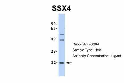 Western Blot: SSX4 Antibody [NBP2-86833] - Host: Rabbit. Target Name: SSX4. Sample Type: Hela. Antibody Dilution: 1.0ug/ml