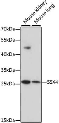 Western Blot: SSX4 Antibody [NBP2-93153] - Analysis of extracts of various cell lines, using SSX4 . Exposure time: 90s.