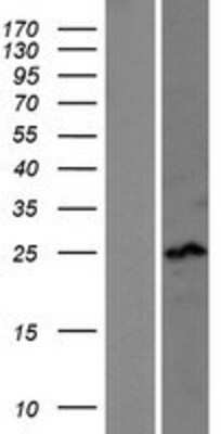 Western Blot: SSX4 Overexpression Lysate (Adult Normal) [NBL1-16487] Left-Empty vector transfected control cell lysate (HEK293 cell lysate); Right -Over-expression Lysate for SSX4.