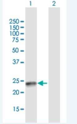 Western Blot: SSX4B Antibody [H00548313-B01P-50ug] - Analysis of SSX4B expression in transfected 293T cell line by SSX4B MaxPab polyclonal antibody.  Lane 1: SSX4B transfected lysate(20.68 KDa).Lane 2: Non-transfected lysate.