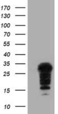 Western Blot SSX5 Antibody (OTI3G6)