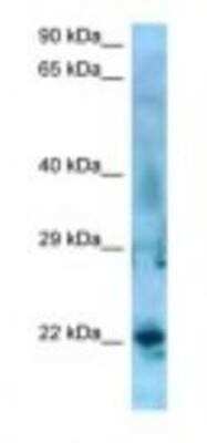 Western Blot: SSX5 Antibody [NBP1-98335] - Jurkat Cell Lysate 1.0ug/ml, Gel Concentration: 12%