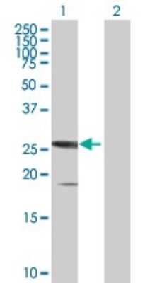 Western Blot SSX5 Antibody