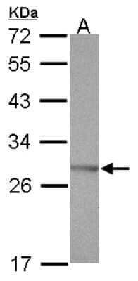 Western Blot: SSX5 Antibody [NBP2-20489] - Sample (30 ug of whole cell lysate) A: Raji 12% SDS PAGE gel, diluted at 1:1000.