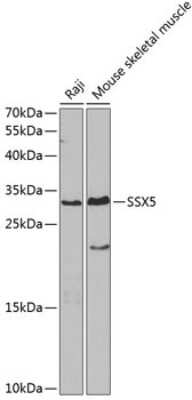 Western Blot: SSX5 Antibody [NBP2-94878] - Analysis of extracts of various cell lines, using SSX5 at 1:1000 dilution. Secondary antibody: HRP Goat Anti-Rabbit IgG (H+L) at 1:10000 dilution. Lysates/proteins: 25ug per lane. Blocking buffer: 3% nonfat dry milk in TBST. Detection: ECL Basic Kit . Exposure time: 90s.
