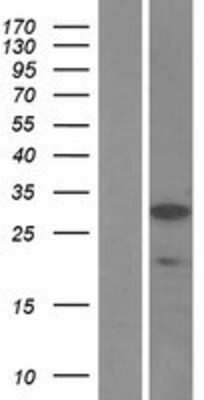 Western Blot: SSX5 Overexpression Lysate (Adult Normal) [NBL1-16488] Left-Empty vector transfected control cell lysate (HEK293 cell lysate); Right -Over-expression Lysate for SSX5.