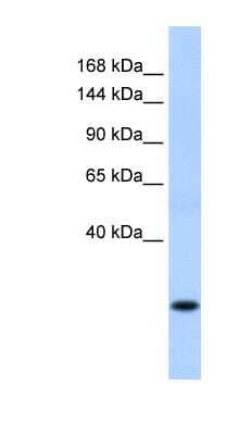 Western Blot SSX8 Antibody