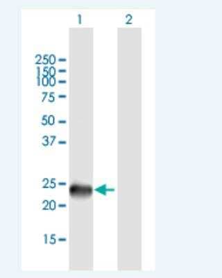 Western Blot: SSX9 Antibody [H00280660-B01P-50ug] - Analysis of SSX9 expression in transfected 293T cell line by SSX9 MaxPab polyclonal antibody.  Lane 1: SSX9 transfected lysate(20.68 KDa). Lane 2: Non-transfected lysate.