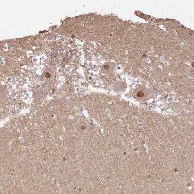 Immunohistochemistry-Paraffin: ST18 Antibody [NBP1-92445] - Staining of human cerebellum shows strong nuclear positivity in Purkinje cells.