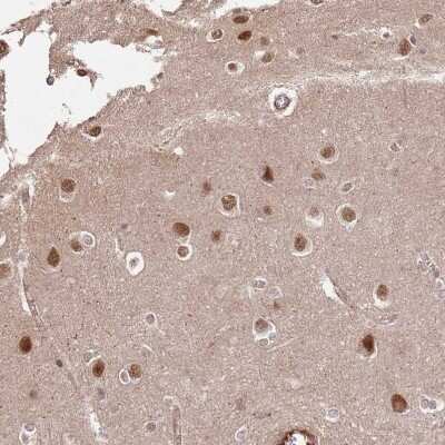 Immunohistochemistry-Paraffin: ST18 Antibody [NBP1-92445] - Staining of human cerebral cortex shows strong nuclear positivity in neurons.