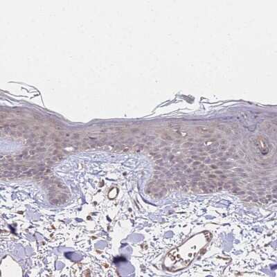 Immunohistochemistry-Paraffin: ST18 Antibody [NBP1-92445] - Staining of human skin shows very weak nuclear positivity in squamous epithelial cells.