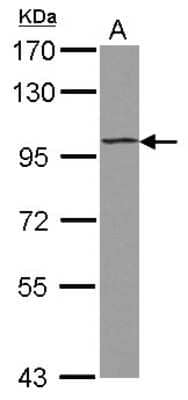 Western Blot: ST18 Antibody [NBP2-20490] - Sample (30 ug of whole cell lysate) A: U87-MG 7. 5% SDS PAGE gel, diluted at 1:1000.