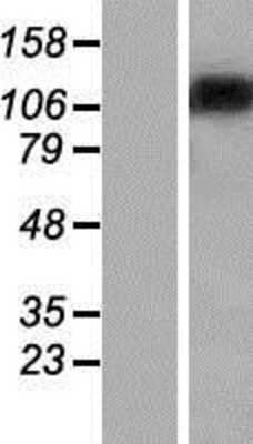 Western Blot: ST18 Overexpression Lysate (Adult Normal) [NBP2-07295] Left-Empty vector transfected control cell lysate (HEK293 cell lysate); Right -Over-expression Lysate for ST18.