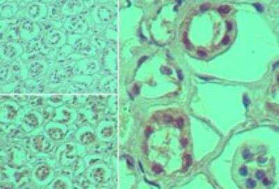 Immunohistochemistry-Paraffin: ST2/IL-1 R4 Antibody [NBP2-24736] - Analysis of ST2 in formalin-fixed, paraffin-embedded human kidney tissue using an isotype control (top left) and this antibody (bottom left, right) at 5 ug/ml.