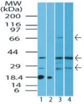 Western Blot: ST2/IL-1 R4 Antibody [NBP2-24736] - Analysis of ST2 protein in human kidney lysate in the 1) absence and 2) presence of immunizing peptide, 3) mouse kidney and 4) rat kidney lysate using this antibody. 0 ug/ml. I goat anti-rabbit Ig HRP secondary antibody and PicoTect ECL substrate solution were used for this test.
