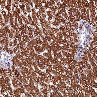 Immunohistochemistry-Paraffin: ST3 beta-Gal alpha-2,3-Sialyltransferase 1/ST3GAL1/SIAT4A Antibody [NBP1-87045] - Staining of human liver shows strong cytoplasmic positivity in hepatocytes.