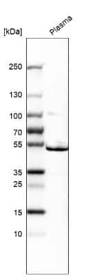 Western Blot: ST3 beta-Gal alpha-2,3-Sialyltransferase 1/ST3GAL1/SIAT4A Antibody [NBP1-87045] - Analysis in human plasma.