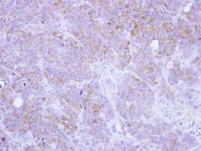 Immunohistochemistry-Paraffin: ST3 beta-Gal alpha-2,3-Sialyltransferase 2/ST3GAL2 Antibody [NBP1-32451] -  Paraffin-embedded SW480 xenograft, using antibody at 1:100 dilution.