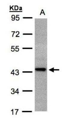 Western Blot: ST3 beta-Gal alpha-2,3-Sialyltransferase 2/ST3GAL2 Antibody [NBP1-32451] - Sample(30 ug whole cell lysate)A:H129910% SDS PAGE, antibody diluted at 1:1000.