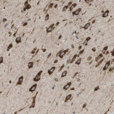 Immunohistochemistry-Paraffin: ST3GAL2 Antibody [NBP1-87044] - Staining of human hippocampus shows strong cytoplasmic positivity in neuronal cells.