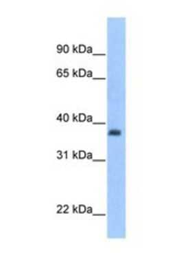 Western Blot: ST3GAL2 Antibody [NBP1-69570] - This Anti-ST3GAL2 antibody was used in Western Blot of Fetal Heart tissue lysate at a concentration of 1ug/ml.