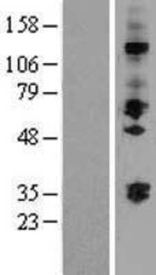 Western Blot: ST3GAL2 Overexpression Lysate (Adult Normal) [NBP2-07558] Left-Empty vector transfected control cell lysate (HEK293 cell lysate); Right -Over-expression Lysate for ST3GAL2.