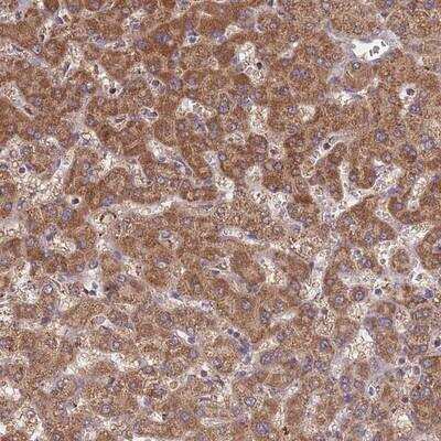 Immunohistochemistry-Paraffin: ST3GAL3 Antibody [NBP2-13389] - Staining of human liver shows strong cytoplasmic positivity in hepatocytes.