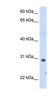 Western Blot: ST3GAL3 Antibody [NBP1-60067] - Human Muscle lysate, concentration 1.25ug/ml.