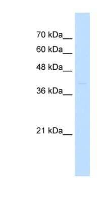 Western Blot: ST3GAL3 Antibody [NBP1-62554] - Jurkat cell lysate, concentration 0.2-1 ug/ml.