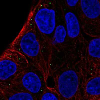 Immunocytochemistry/Immunofluorescence: ST3GAL5 Antibody [NBP2-56522] - Staining of human cell line RT4 shows localization to vesicles.