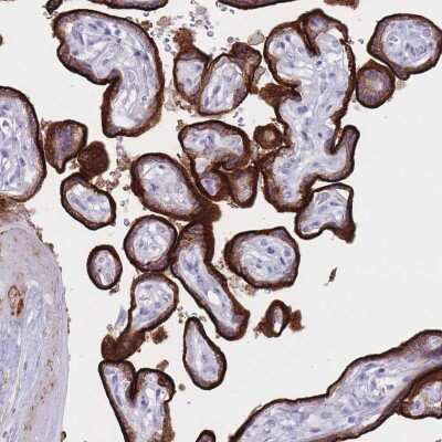 Immunohistochemistry: ST3GAL5 Antibody [NBP2-32612] - Staining of human placenta shows strong cytoplasmic positivity in trophoblastic cells.