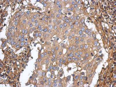 Immunohistochemistry-Paraffin ST3GAL5 Antibody