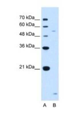 Western Blot: ST3GAL5 Antibody [NBP1-62444] - Titration: 1.25ug/ml Positive Control: Jurkat cell lysate.