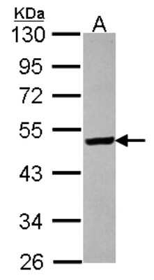 Western Blot ST3GAL5 Antibody