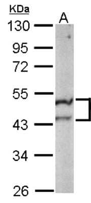 Western Blot ST3GAL5 Antibody