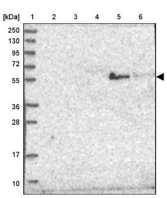 Western Blot: ST3GAL5 Antibody [NBP2-32612] - Lane 1: Marker  [kDa] 250, 130, 95, 72, 55, 36, 28, 17, 10.  Lane 2: Human cell line RT-4.  Lane 3: Human cell line U-251MG sp.  Lane 4: Human plasma (IgG/HSA depleted).  Lane 5: Human liver tissue.  Lane 6: Human tonsil tissue