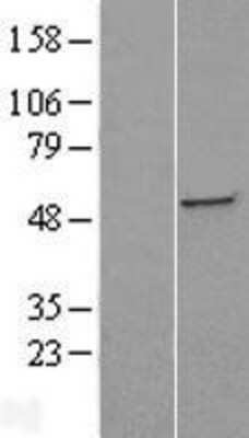 Western Blot: ST3GAL5 Overexpression Lysate (Adult Normal) [NBL1-16493] Left-Empty vector transfected control cell lysate (HEK293 cell lysate); Right -Over-expression Lysate for ST3GAL5.