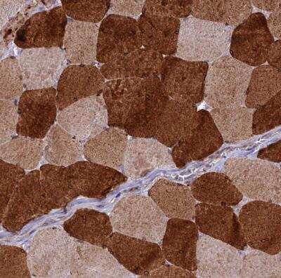 Immunohistochemistry-Paraffin ST3GAL6 Antibody - BSA Free